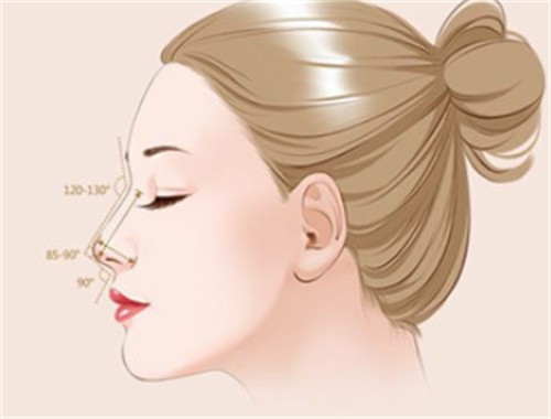 武漢藝星劉駿隆鼻技術(shù)值得推薦,原生肋骨鼻綜合價(jià)格3萬(wàn)起自然可揉捏