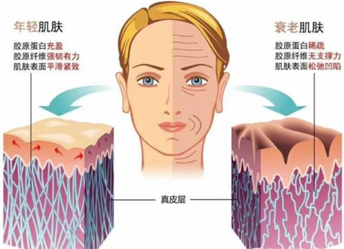 武漢藝星半島超聲炮+第四代熱瑪吉聯(lián)合抗皺，洪霞醫(yī)生親診價(jià)9800起