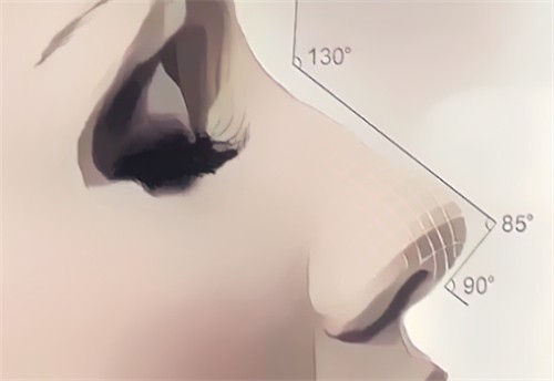 武漢同濟(jì)醫(yī)學(xué)院醫(yī)院吳輝做鼻子很自然，12800起做膨體隆鼻+鼻尖塑形技術(shù)不錯(cuò)