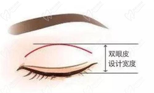 武漢藝星整形醫(yī)院眼部整形價(jià)格表