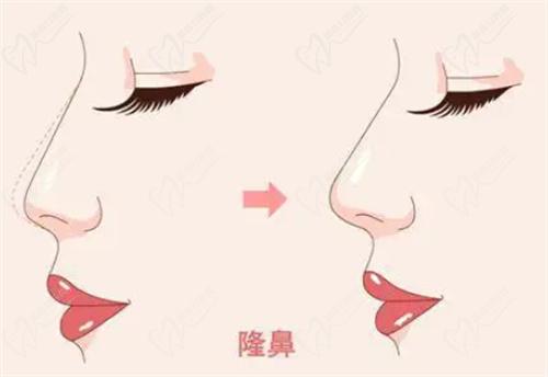 武漢藝星做鼻子怎么樣？