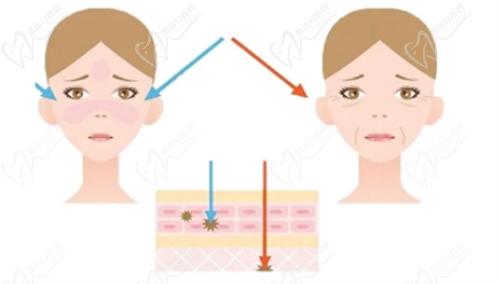 武漢熱瑪吉官方認(rèn)證醫(yī)院
