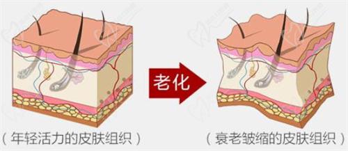 武漢藝星半島超聲炮+第四代熱瑪吉聯(lián)合抗皺9800元起