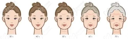 皮膚老化