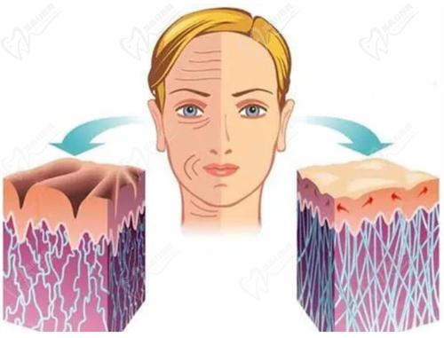 超聲炮+熱瑪吉，能解決哪些肌膚問(wèn)題？