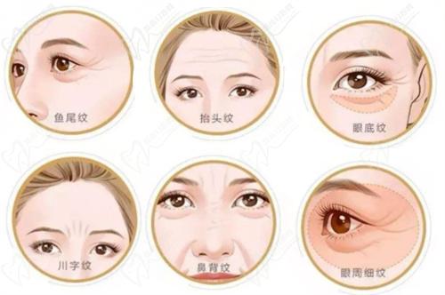 半島超聲炮+熱瑪吉實(shí)現(xiàn)全程抗衰