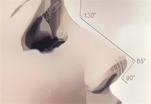 武漢藝星整形醫(yī)院耳軟骨復(fù)合隆鼻價(jià)格