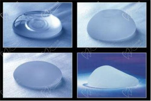 徐國建醫(yī)生做曼托圓盤光面假體隆胸技術(shù)精良