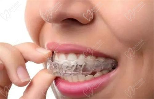 潘牛兵正畸醫(yī)術怎么樣啊