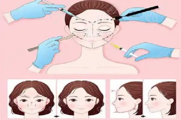 武漢藝星朱勝軍打除 皺針注射過程詳解