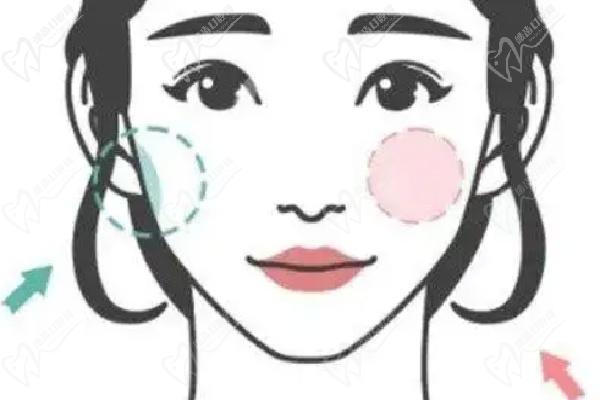 武漢藝星朱勝軍打除 皺針預(yù)約掛號(hào)