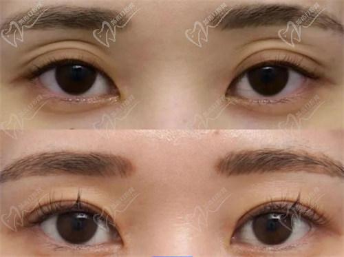 三、南京美萊王小林醫(yī)生手術(shù)特色與技術(shù)優(yōu)勢：