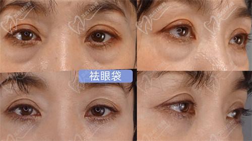 四、南京美萊王小林醫(yī)生正規(guī)嗎？