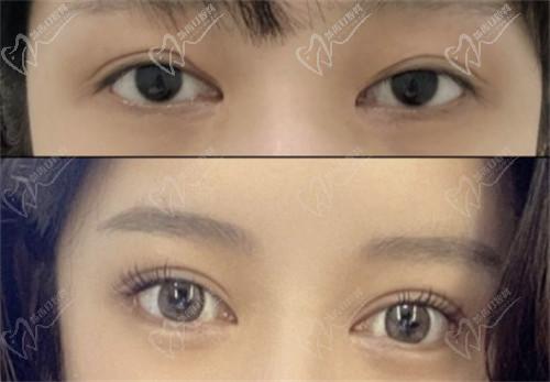 五、南京美萊王小林醫(yī)生患者評(píng)價(jià)與反饋