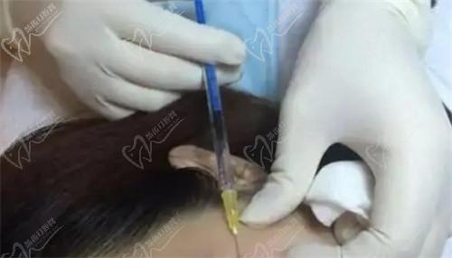 南京美萊譚小梅醫(yī)生