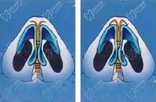 武漢張繼強(qiáng)跟曾寧誰(shuí)厲 害