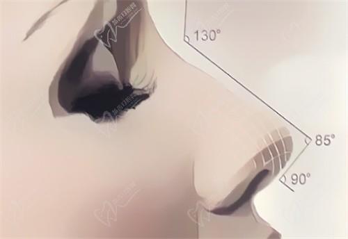 武漢藝星整形做耳軟骨復(fù)合隆鼻價(jià)格在16800元起，楊國(guó)梁技術(shù)好